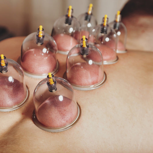 Hijama Cups